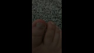 Cut my toenail too short!