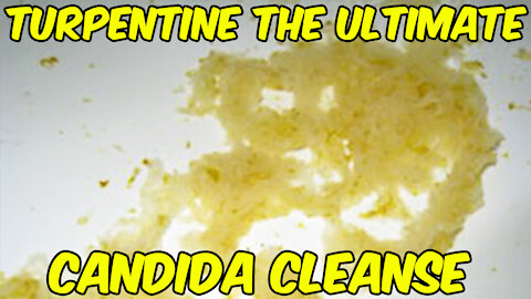 Why Turpentine Is The Ultimate Candida Cleanse!