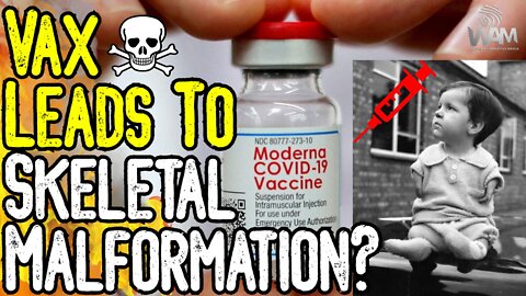 EXPOSED: VAX LEADS TO SKELETAL MALFORMATION! - Moderna Docs REVEALED! - Babies At Risk!