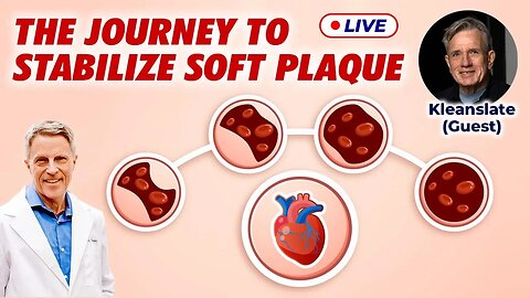 The Journey to Stabilize Soft Plaque (LIVE)