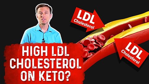 Why High LDL Cholesterol on the Ketogenic Diet? – Dr. Berg