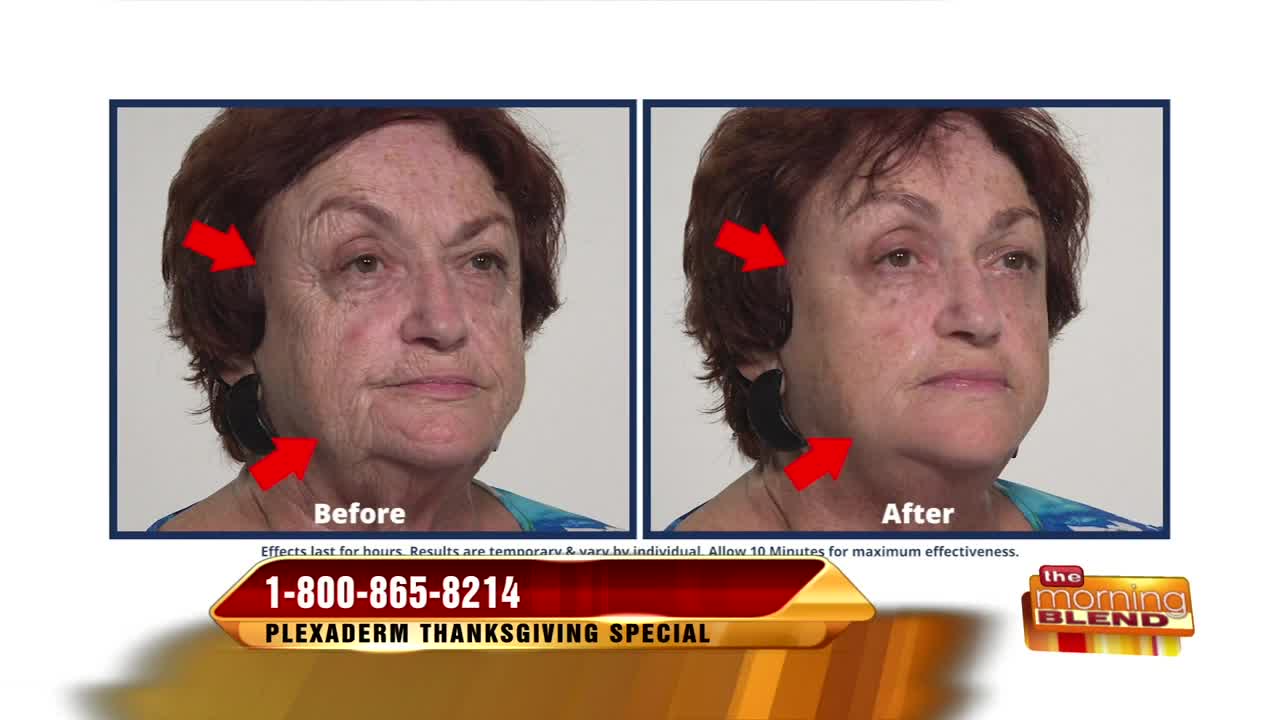 Look Younger and Wow Your Family this Holiday Season