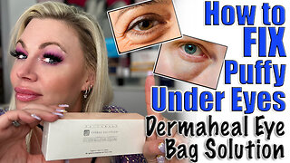 How to Fix Puffy Under Eyes: Dermaheal EBS, AceCosm | Code Jessica10 saves you Money at All Vendors