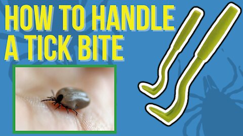 How to Handle a Tick Bite