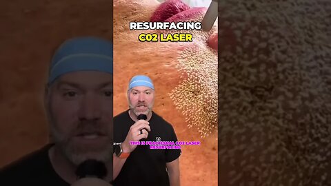 How CO2 Lasers Tighten Your Skin 🤯 #shorts