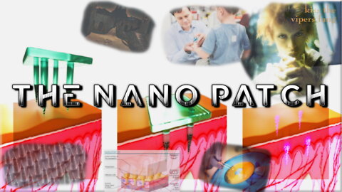 The Nano Patch (Part 2)