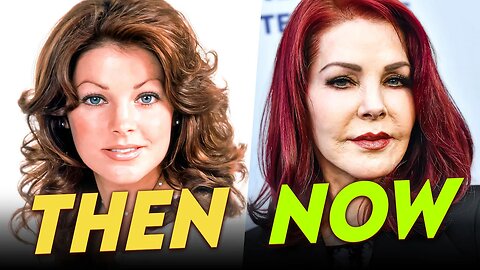 Priscilla Presley | Before & After | Plastic Surgery Transformation