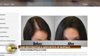 HAIR RESTORATION AND AESTHETICS OF BUFFALO