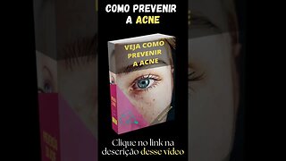 Como prevenir a Acne #shorts