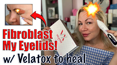 Fibroblast my Eyelids with Velatox to Speed up Healing from Acecosm| Code Jessica10 Saves you Money!