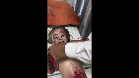 تخيل قبل ساعة #فيديو | طفلة مصابة في قصف الاحتلال خيام النازحين غرب خانيونس.