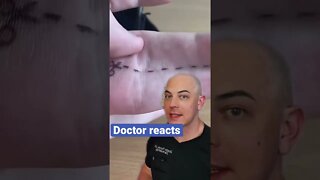 Doctor reacts to interesting condition!