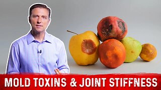 Mycotoxins & Joint Stiffness Pain – Causes, Symptoms & Remedy By Dr. Berg