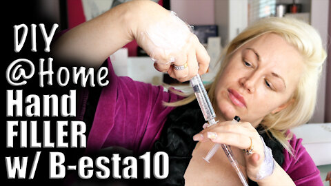 Rejuvinate aging hands with B-esta10 Body Filler: Round 1| Code Jessica10 Saves you Money!