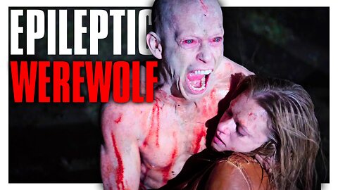 The HORRIFIC REALITY Of Lycanthrophy Exposed | Wer Explored
