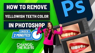 How To Remove Yellowish Teeth Color In Photoshop.