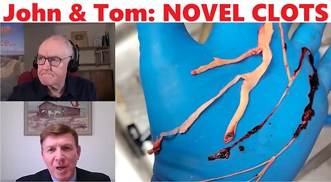 John & Tom: NOVEL CLOTS