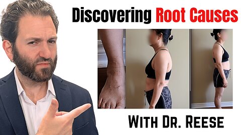 Dr. Reese Finds Sway Back and Bunions on a Woman