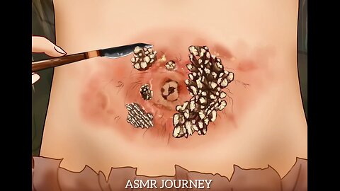 ASMR Animation |A girl with a skin condition healing her belly button || #asmr #asmrsounds #relaxing