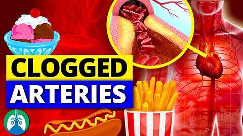❣️Top 10 WORST Foods that CLOG Your Arteries (NEVER EAT THIS)
