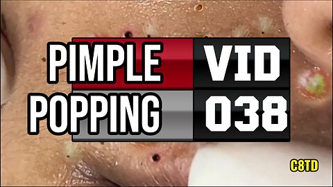 Satisfying Pimple Popping Videos 038