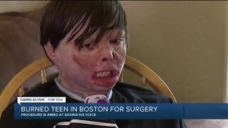 Burned teen in Boston for surgery