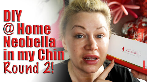 DIY Kybella in my Chin (Neobella from www.glamderma.com) | Code Jessica10 Saves you Money!