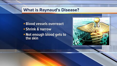 Ask Dr. Nandi: What you need to know about Raynaud's disease