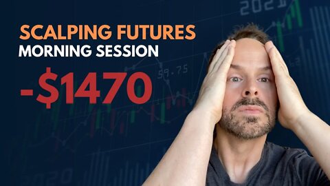 WATCH ME TRADE | -$1470 LOSS | DAY TRADING Nasdaq Futures Trading - Scalping Day Trading