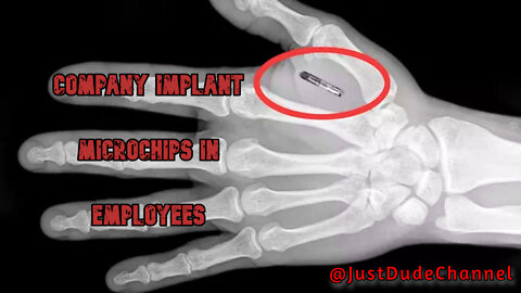 Tech Company Implant Microchips In Employees