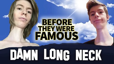 DAMN LONG NECK | Before They Were Famous | INSTAGRAM STAR