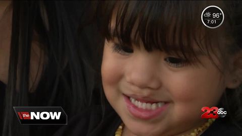 'Cleft Cuties' hope to spread awareness through common difference