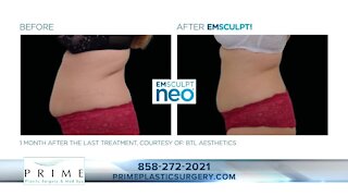 Dr. James Chao of Prime Plastic Surgery & Medical Spas talks body contouring and EmSculpt Neo