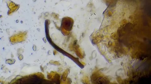 Bio-Complete Compost under microscope! The HOLY GRAIL of farming!