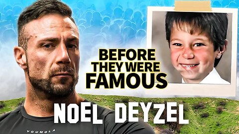 Noel Deyzel | Before They Were Famous | Zyzz of Our Generation