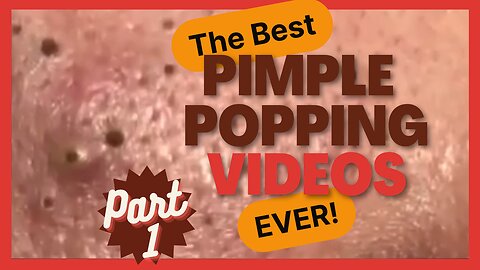 The BEST pimple POPPING videos EVER (p1)