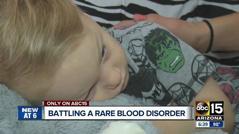 Casa Grande toddler living with rare blood disorder