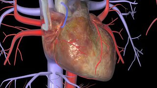 Derivación o revascularización coronaria (CABG)