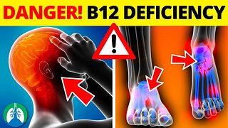 ⚠️ Top 10 DANGERS of Vitamin B12 Deficiency ▶ BEWARE ❗