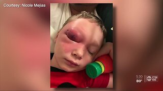 Florida boy gets infection on cruise