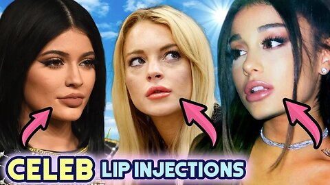 Celebrities With Lip Injections | Real or Fake? | Kylie Jenner, Ariana Grande, Lindsay Lohan & More!