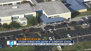 Clearwater student burned himself with a lighter at school