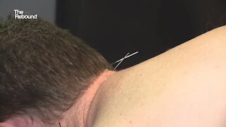 Some Las Vegans using acupuncture to treat anxiety