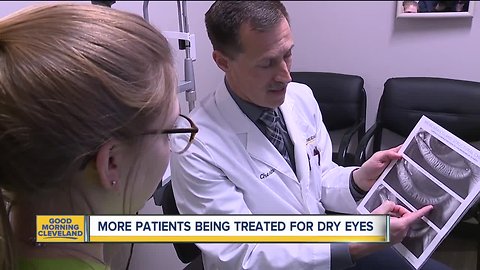 Doctors seeing younger patients diagnosed with chronic dry eye