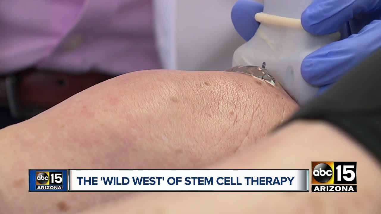 What to know about stem cell therapy in the Valley
