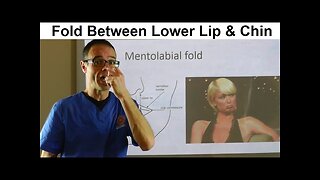 Importance of a Fold Between Lower Lip & Chin Muscle, Mentolabial Fold by Dr Mike Mew