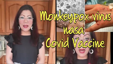 Mam Lynn Agno 》 Monkeypox virus nasa Covid Vaccine