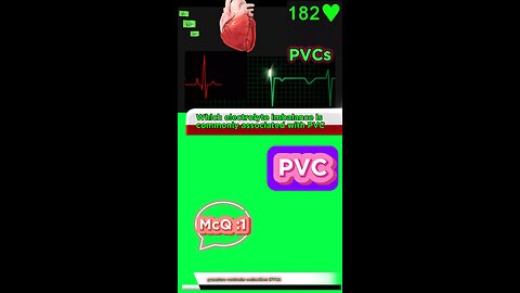 PVC #pvc #arrthymias #cardaic #heart prematureventricle tachycardia