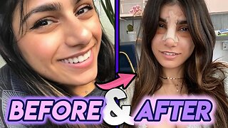 Mia Khalifa | Before & After | New Nose Job