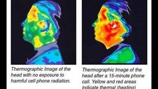 This is Your Brain on 5G, Any Questions?